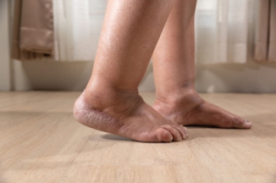 Causes of Swollen Feet From Daily Activities