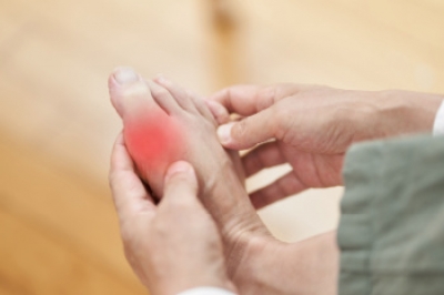 Gout and Bunion Confusion
